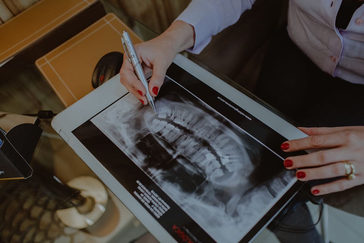 Mouth X-ray